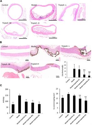 Triptolide Attenuates Vascular Calcification by Upregulating Expression of miRNA-204